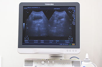 超音波検査装置（腹部・精巣エコー）